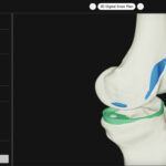 patient-specific 3D models