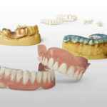 Printed dental items