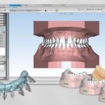 SHINING 3D Collaborates With AGE For Accelerating Dental Solution