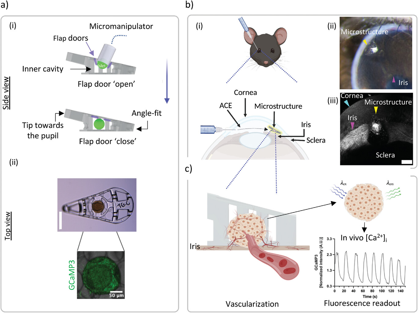 Researchers 3D Print Eye Implant for Diabetes Treatment