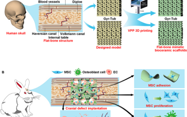 Bioceramic Scaffolds: A Novel Approach to Cranial Bone Regeneration